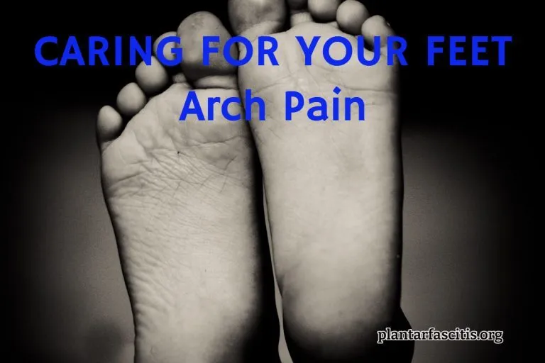 CARING FOR YOUR FEET Arch Pain