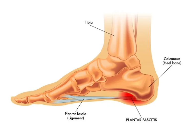 Plantar Fasciitis Stretches in Bed