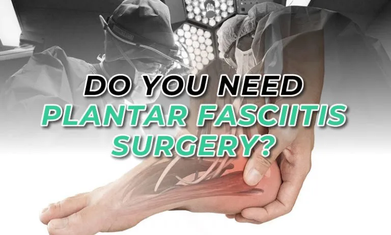 Can Plantar Fasciitis Go Away on Its Own?