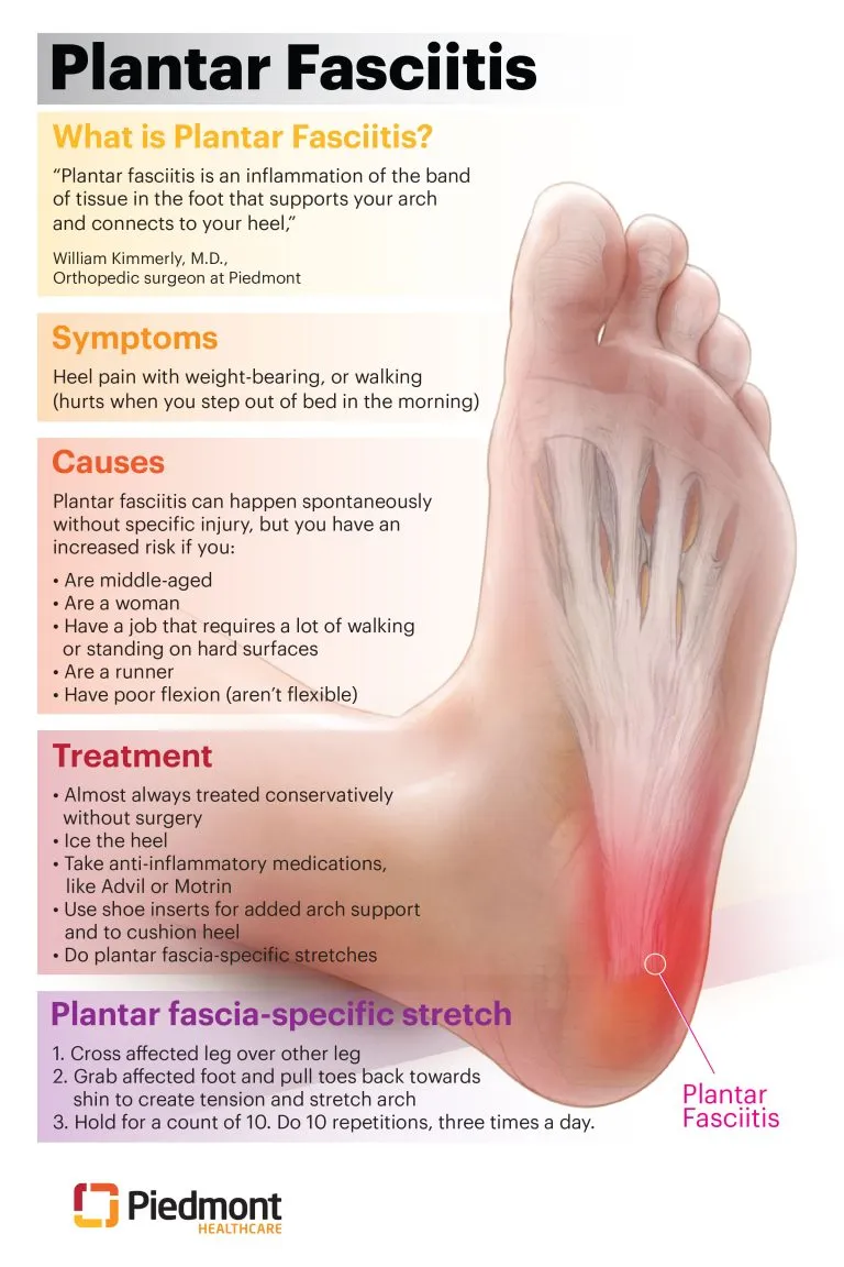 How Long Does Plantar Fasciitis Last?