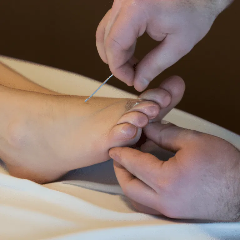 Doctor Doing acupuncture of a females feet using acupuncture needles