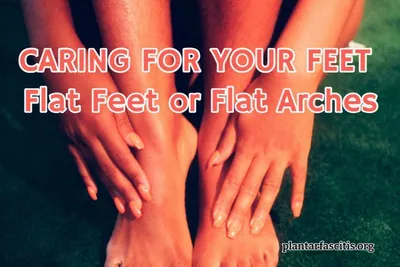 CARING FOR YOUR FEET Flat Feet or Flat Arches