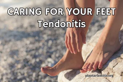 CARING FOR YOUR FEET Tendonitis
