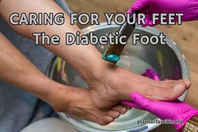CARING FOR YOUR FEET - The Diabetic Foot