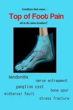Top of Foot Pain Causes