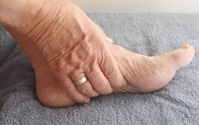 Common Foot Problems in Older Adults