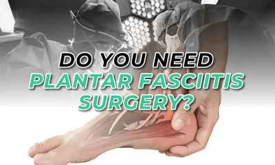 Can Plantar Fasciitis Go Away on Its Own?